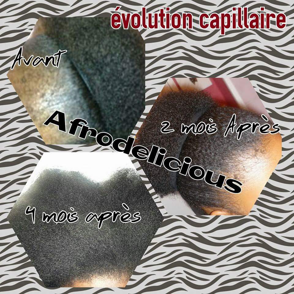 evolution capillaire